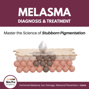 Melasma (Diagnosis and Treatment)