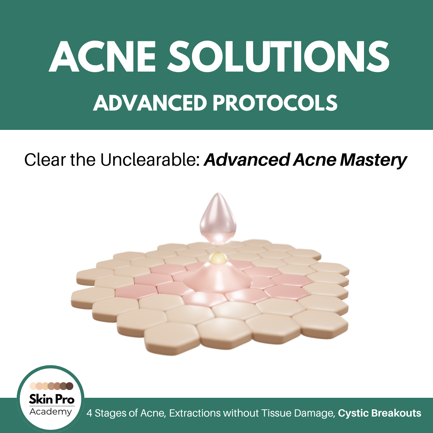 Acne Solutions (Advanced Protocols)