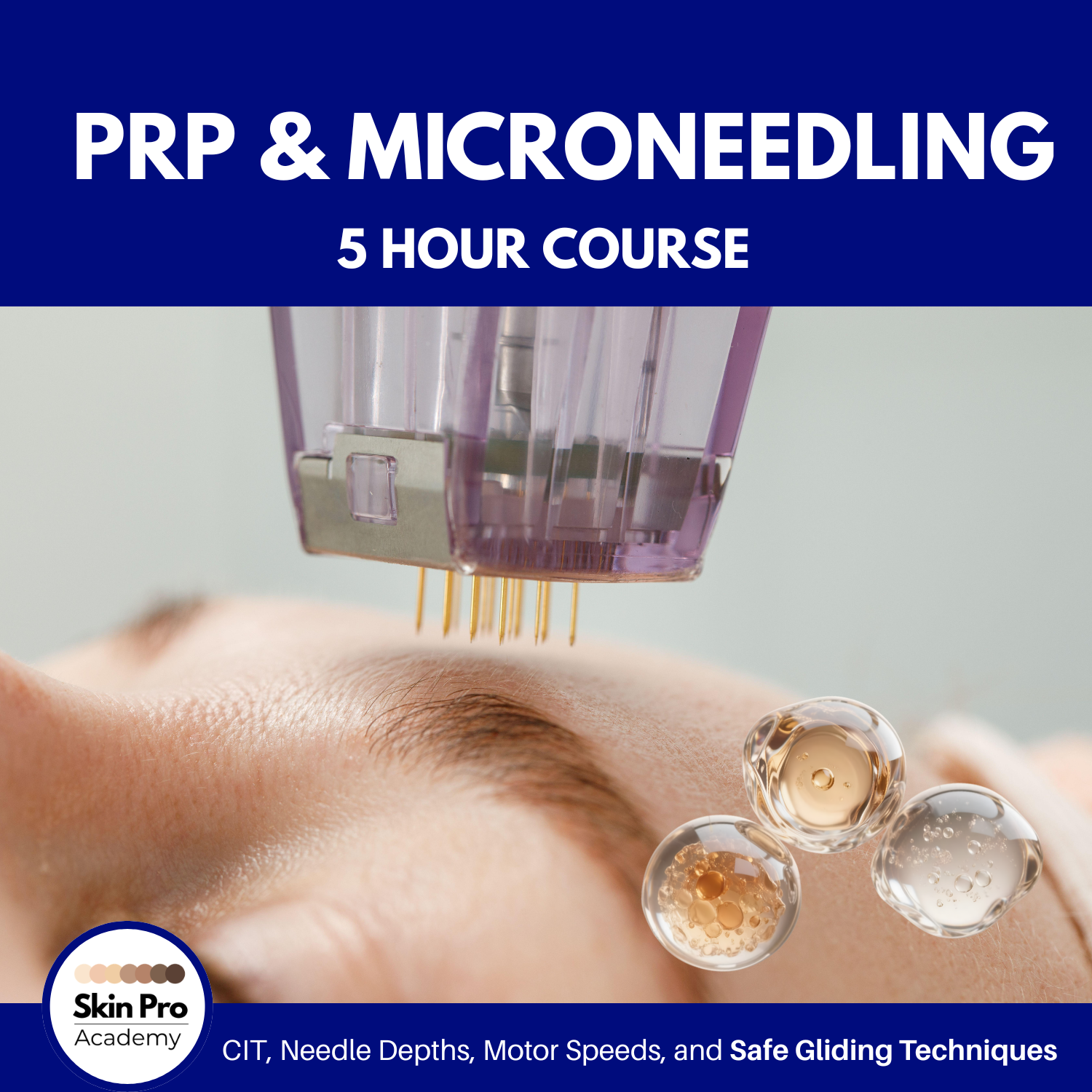 Take a PRP and Microneedling Course for Estheticians with SkinPro Academy. Educators with over 27 years of experience teaching for the top brands in the world.